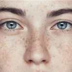 Facial Freckles (FREE)