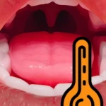 Oral Heating